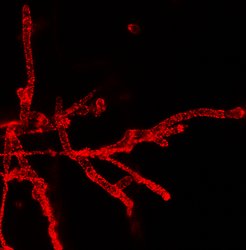 Ustilago maydis hyphae inside an infected maize leaf. The red spots are caused by a fluorescent protein that is fused to one of the proteins in the surface-exposed complex.