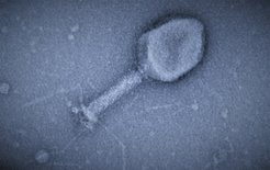 Elektronenmikroskopische Aufnahme eines T4 Bakteriophagen. Der T4-Phage zerstört E. coli-Zellen schneller als ein Antibiotikum wirkt.