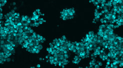 Die Bierhefe (Saccharomyces cerevisiae), seit Jahrtausenden zum Brotbacken und Bierbrauen genutzt, wird als „mikrobielles Arbeitspferd der Biotechnologie“ eingesetzt, um chemische Wertstoffe zu bilden. Der Neubau ihres Genoms verspricht neue Möglichkeiten, die Prozesse effizienter, kostengünstiger und nachhaltiger zu machen. (Foto: Z-Stack-Projektion von mit mTurquoise2 markierten S. cerevisiae-Zellen, aufgenommen mit konfokalem Mikroskop Zeiss LSM-800.)