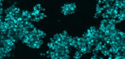 Brewer's yeast (Saccharomyces cerevisiae), which has been used for thousands of years to bake bread and brew beer, is a "microbial workhorse of biotechnology" and is used to produce valuable chemical substances. The re-engineering of its genome promises new opportunities to make processes more efficient, cost-effective and sustainable. (Foto: Z-Stack-Projection of S. cerevisiae stained with mTurquoise2 , confokal Mikroskope Zeiss LSM-800.)
