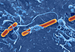 Shigella flexneri , here invading an embryonic stem cell.