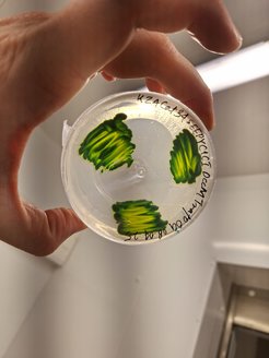 Eine Petrischale mit grünen Proben, wird von einer Hand unter Laborlicht gehalten.