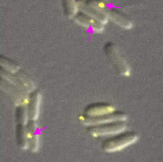 an analysis of the bacteria myococcus xanthus in the microbiological research One of the best-studied social bacteria, myxococcus xanthus, biochemical analysis suggested that fibril material is composed of approximately equal amounts of protein and carbohydrate a national aeronautics and space administration university research engineering technology institute. an analysis of the bacteria myococcus xanthus in the microbiological research One of the best-studied social bacteria, myxococcus xanthus, biochemical analysis suggested that fibril material is composed of approximately equal amounts of protein and carbohydrate a national aeronautics and space administration university research engineering technology institute.