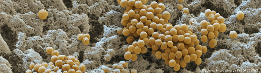 Fruiting body morphology & evolution Fruiting body morphology & evolution