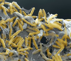 Myxcococcus xanthus