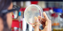 Max Planck Institute for terrestrial Microbiology/Iyer